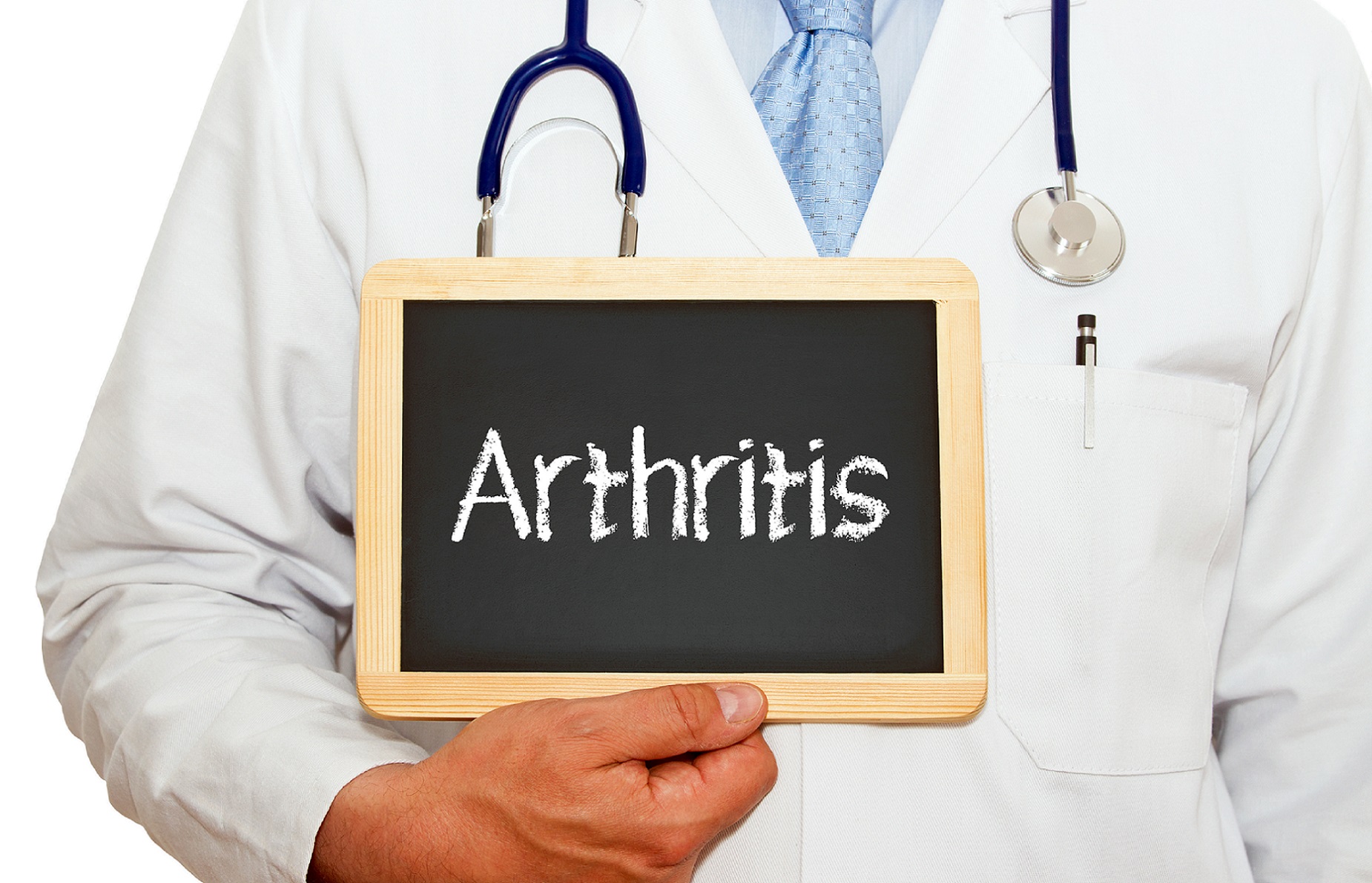artritis reumatoide