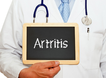 acerca de la artritis reumatoide